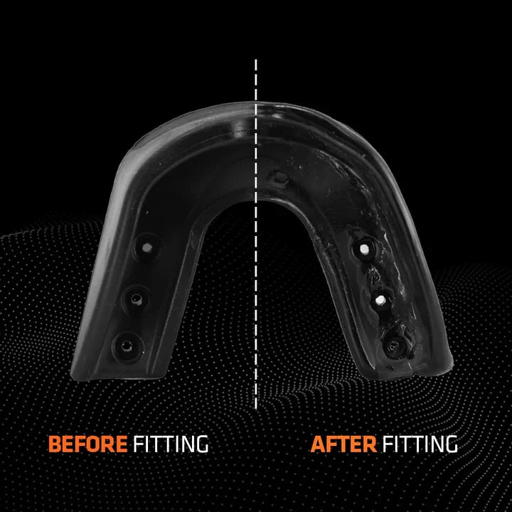 Pro Smoke Youth Mouthguard